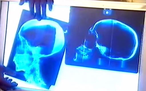 Tut on left - 1st degree relative on right